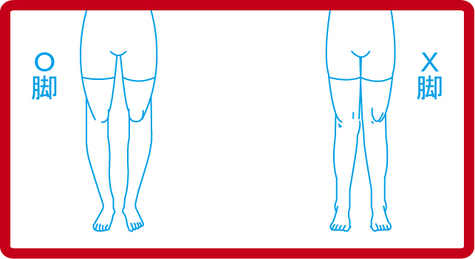 内股、O脚、膝の問題にあなただけのインソール、オーダーメイドシューズが作れます(義肢装具士を囲い込むカイロ院)