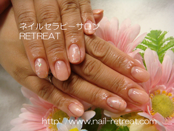 逆フレンチで小花柄にム-ンネイル