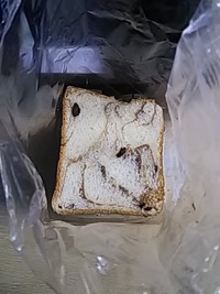 抜歯。