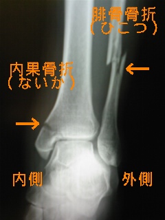 大黒柱が折れました・・・