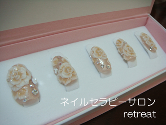 豪華ブラダイルオ－ダ－チップ
